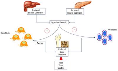 The Bones of Children With Obesity